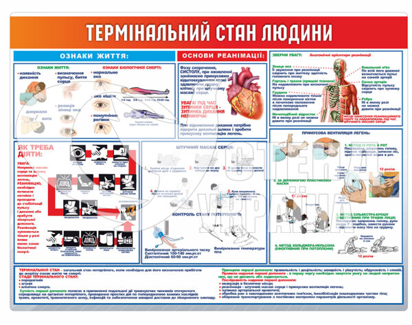 Стенд «Термінальний стан людини»